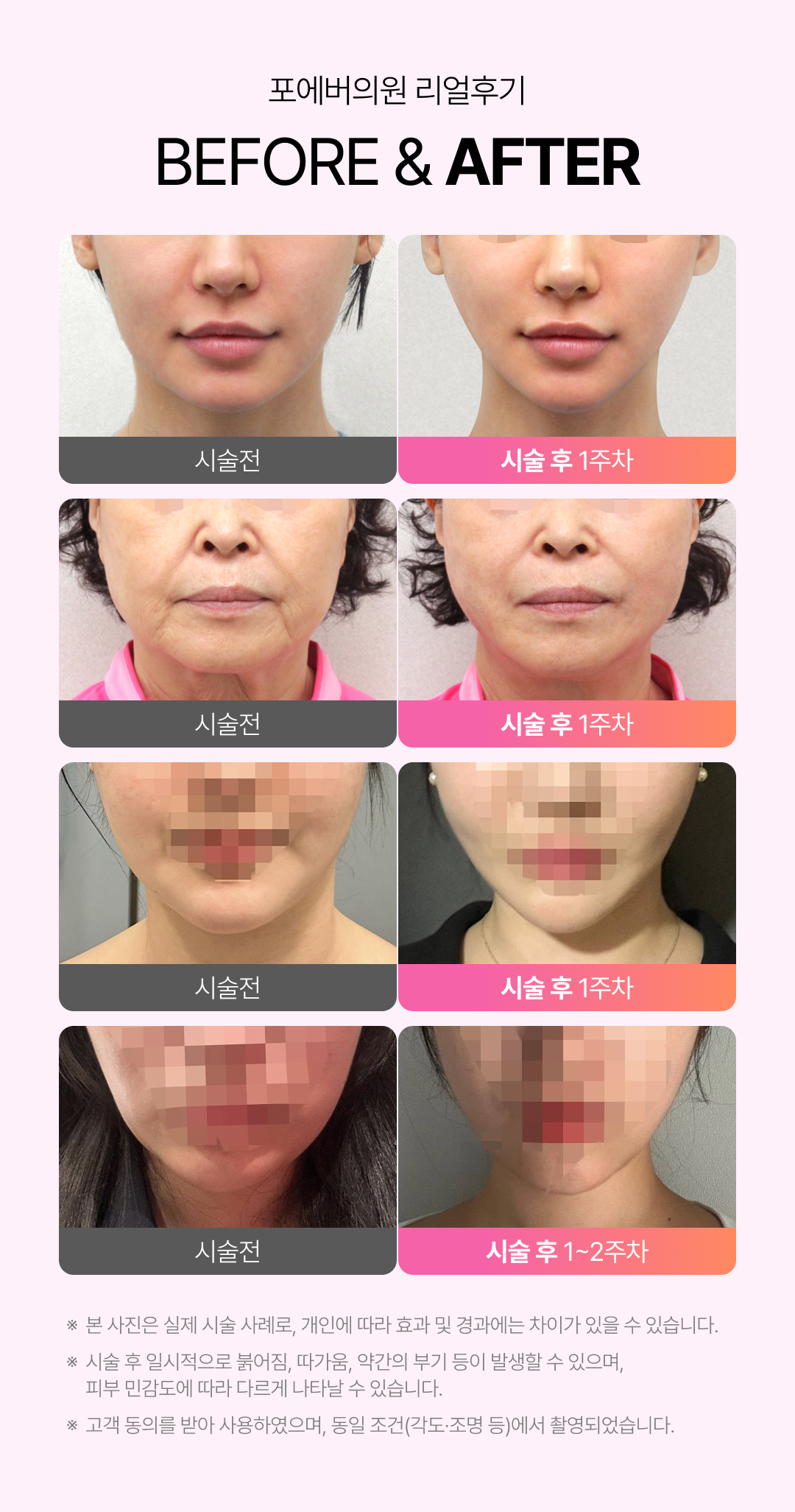 슈링크